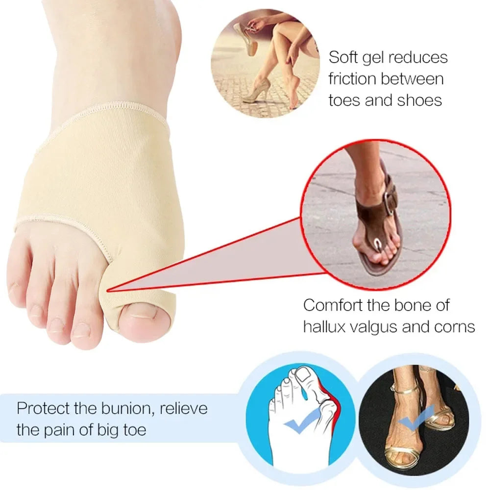 Hallux Valgus Bunion Corrector — Soft Toe Separator & Straightener (2pcs)
