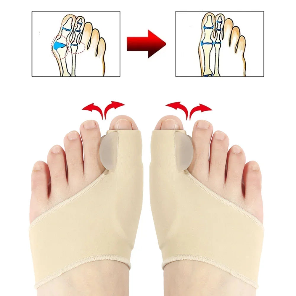 Hallux Valgus Bunion Corrector — Soft Toe Separator & Straightener (2pcs)